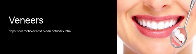 Veneers